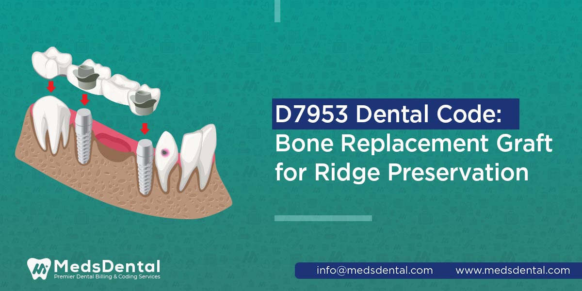 D7953 Dental Code: Bone Replacement Graft for Ridge Preservation