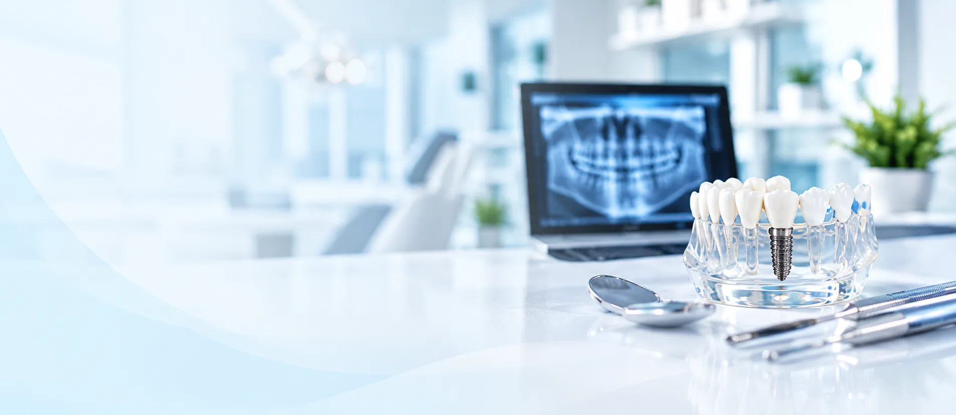 Dental implant model and instruments on a clinic counter beside a panoramic X-ray on a monitor